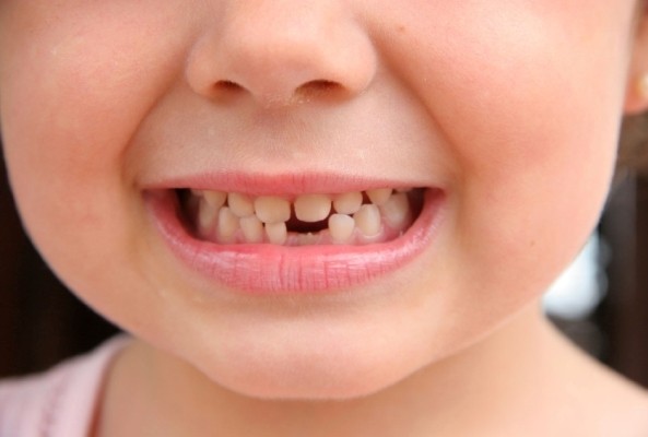 Молочні зуби, традиційно, починають випадати у віці 6-7 років. Та нас цікавить, як за ними доглядати, аби вони служили якомога довше?
