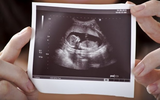 Це дивно, але на 5 тижні вагітності серце вашого малюка вже почало битися. Це можна чітко побачити на УЗД. Попросіть лікаря, зробити першу фотографію 