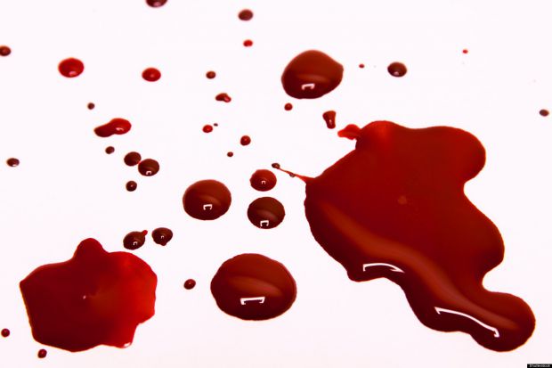 Шведські медики назвали групу крові, володарі якої менше схильні до ризику захворіти на рак. Виявилося, що найменше число пацієнтів з онкологією було 