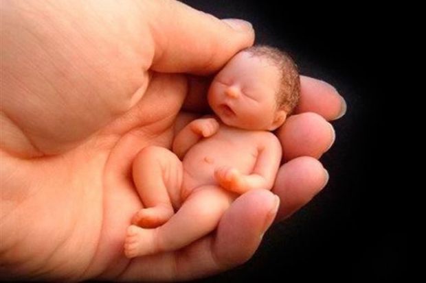 Аборт - це переривання вагітності на терміні до 22 тижнів. Аборти бувають мимовільними (викидні) і штучними (шляхом хірургічного або іншого втручання)