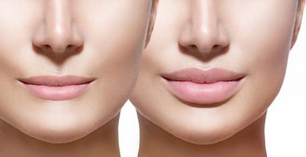 Власниці вузиких губ, як ніхто, знають, чого вартий той біль під час процедури збільшення губ в кабінеті косметолога. Та чи в курсі вони, що не можна 