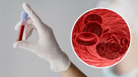 Дослідження, проведене Університетом Альберти, показує, що анемія викликає різні імунологічні реакції у чоловіків та жінок.