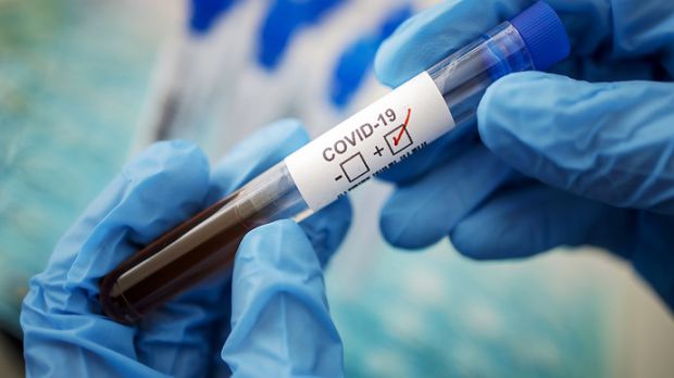 В Україні 7,7 мільйона осіб повністю вакцинувалися від коронавірусу. Це становить 17,5% населення. Проте результати соціологічного опитування 