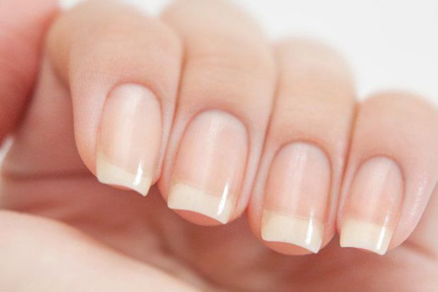 Зовнішній вигляд ваших нігтів може змінюватися в залежності від певних захворювань. Хвороба нирок пов’язана з кількома характерними проблемами з нігтя