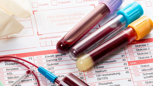 Вченими названі групи крові, чиї власники відрізняються особливо сильним імунітетом до інфекцій.