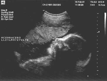 pregnancy-ultrasound-31-weeks.jpg