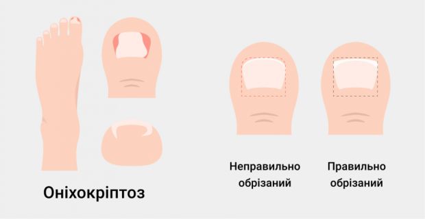 8023_ni.jpg (13.16 Kb)