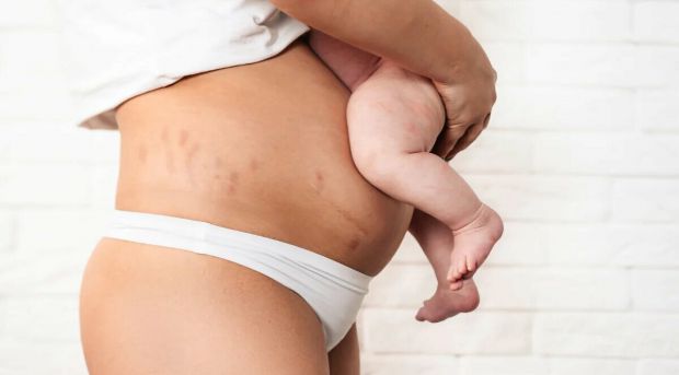 10 симптомів після пологів, які не можна ігнорувати Пологи – значне навантаження для жіночого організму, тому після них породілля потребує час для відновлення сил і здоров’я. Впродовж цього періоду жінк